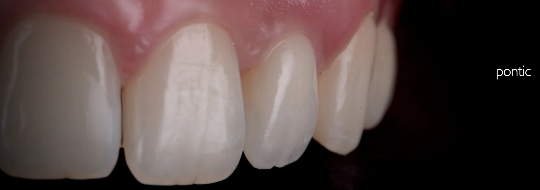 Perio Plastic Procedures in Restorative Practice - dec 2024