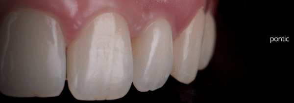 Perio Plastic Procedures in Restorative Practice - dec 2024
